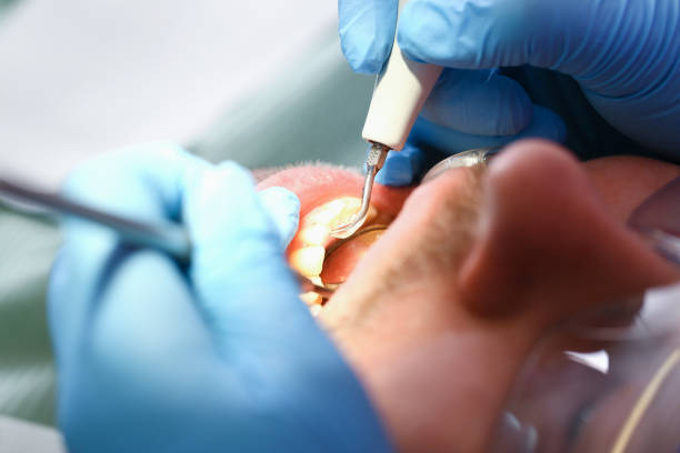 Best Emergency Dental Services for Seniors in Blissfield, MI