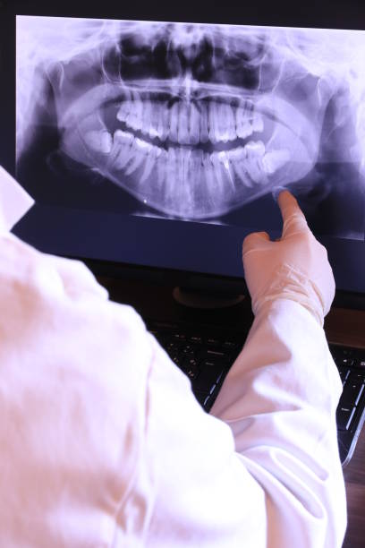 Best Broken or Cracked Tooth Emergency Dentist in Blissfield, MI